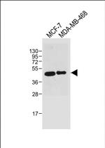 SULT2B1 Antibody in Western Blot (WB)