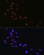 MATR3 Antibody in Immunocytochemistry (ICC/IF)