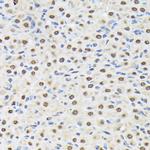 MATR3 Antibody in Immunohistochemistry (Paraffin) (IHC (P))