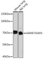 GAD67 Antibody in Western Blot (WB)