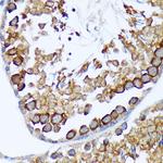 TACC3 Antibody in Immunohistochemistry (Paraffin) (IHC (P))