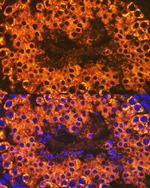 CLGN Antibody in Immunocytochemistry (ICC/IF)