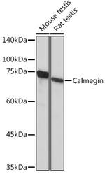 CLGN Antibody in Western Blot (WB)