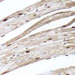 Ubiquitin Antibody in Immunohistochemistry (Paraffin) (IHC (P))