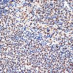 PHAPI2 Antibody in Immunohistochemistry (Paraffin) (IHC (P))