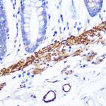 Desmin Antibody in Immunohistochemistry (Paraffin) (IHC (P))