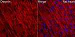 Desmin Antibody in Immunohistochemistry (Paraffin) (IHC (P))