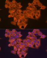 PIK3R4 Antibody in Immunocytochemistry (ICC/IF)