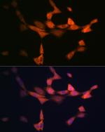 PIK3R4 Antibody in Immunocytochemistry (ICC/IF)