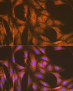 UAP1 Antibody in Immunocytochemistry (ICC/IF)