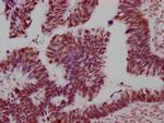 SMC1 Antibody in Immunohistochemistry (Paraffin) (IHC (P))