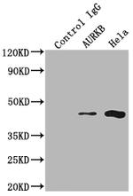 Aurora B Antibody in Immunoprecipitation (IP)