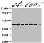 Aurora B Antibody in Western Blot (WB)