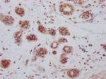 Bcl-xL Antibody in Immunohistochemistry (Paraffin) (IHC (P))