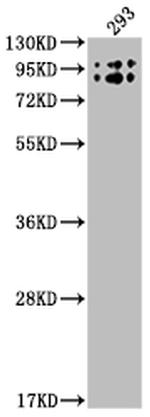 Butyrylcholinesterase Antibody in Western Blot (WB)