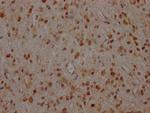 MEK1 Antibody in Immunohistochemistry (Paraffin) (IHC (P))