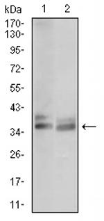 Tartrate Resistant Acid Phosphatase Antibody in Western Blot (WB)