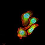 AIM2 Antibody in Immunocytochemistry (ICC/IF)