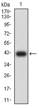 ADAM8 Antibody in Western Blot (WB)