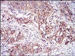 PKR Antibody in Immunohistochemistry (Paraffin) (IHC (P))