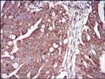 PKR Antibody in Immunohistochemistry (Paraffin) (IHC (P))