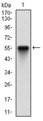 PKR Antibody in Western Blot (WB)