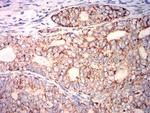 PLA2G7 Antibody in Immunohistochemistry (Paraffin) (IHC (P))