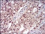 PP1 beta Antibody in Immunohistochemistry (Paraffin) (IHC (P))