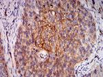 RALB Antibody in Immunohistochemistry (Paraffin) (IHC (P))