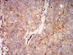 RALB Antibody in Immunohistochemistry (Paraffin) (IHC (P))