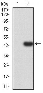 SUZ12 Antibody in Western Blot (WB)