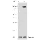 ALPL Antibody in Western Blot (WB)