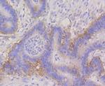 CD49f Antibody in Immunohistochemistry (Paraffin) (IHC (P))