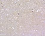 PSD-95 Antibody in Immunohistochemistry (Paraffin) (IHC (P))