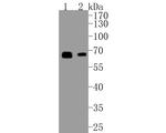 SMAD4 Antibody in Western Blot (WB)