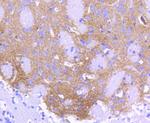 ALDH1A1 Antibody in Immunohistochemistry (Paraffin) (IHC (P))