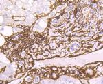 Alpha-Smooth Muscle Actin Antibody in Immunohistochemistry (Paraffin) (IHC (P))