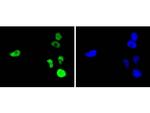 c-Jun Antibody in Immunocytochemistry (ICC/IF)