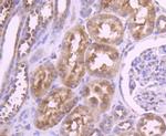 YBX1 Antibody in Immunohistochemistry (Paraffin) (IHC (P))