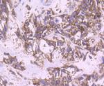 YBX1 Antibody in Immunohistochemistry (Paraffin) (IHC (P))