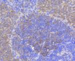 Phospho-eIF4E (Ser209) Antibody in Immunohistochemistry (Paraffin) (IHC (P))