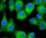 FASN Antibody in Immunocytochemistry (ICC/IF)