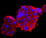 Calbindin D28K Antibody in Immunocytochemistry (ICC/IF)