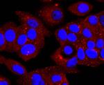 alpha-1 Antitrypsin Antibody in Immunocytochemistry (ICC/IF)