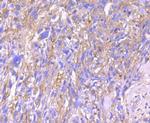 alpha-1 Antitrypsin Antibody in Immunohistochemistry (Paraffin) (IHC (P))