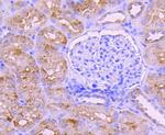 BNIP3 Antibody in Immunohistochemistry (Paraffin) (IHC (P))