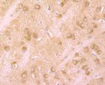 Huntingtin Antibody in Immunohistochemistry (Paraffin) (IHC (P))