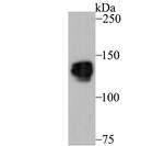 PUM1 Antibody in Western Blot (WB)
