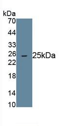 betatrophin Antibody in Western Blot (WB)