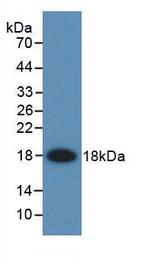 FABP2 Antibody in Western Blot (WB)